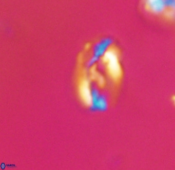 Helicosphaera gartneri VR 33087