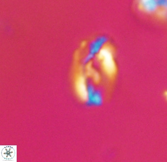 Helicosphaera gartneri VR 33087