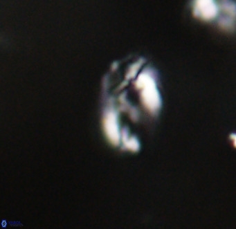 Helicosphaera gartneri VR 33088