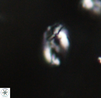 Helicosphaera gartneri VR 33088