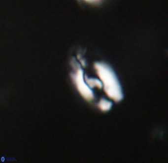 Helicosphaera gartneri VR 33089