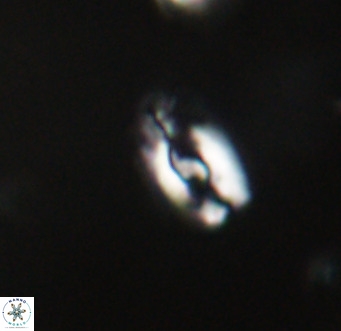 Helicosphaera gartneri VR 33089