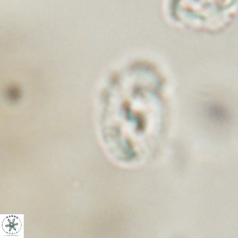 Helicosphaera gartneri VR 33094