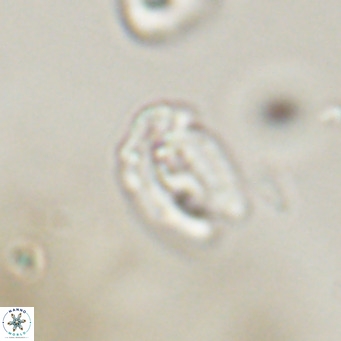 Helicosphaera gartneri VR 33095