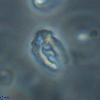 Helicosphaera gartneri VR 33096