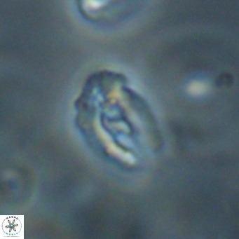 Helicosphaera gartneri VR 33096