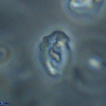 Helicosphaera gartneri VR 33097