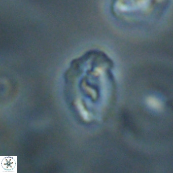 Helicosphaera gartneri VR 33097