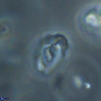 Helicosphaera gartneri VR 33098