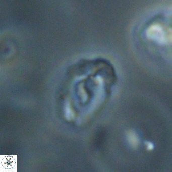 Helicosphaera gartneri VR 33098