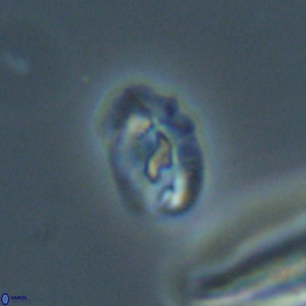 Helicosphaera gartneri VR 33099