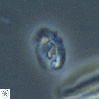 Helicosphaera gartneri VR 33099