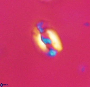 Helicosphaera gartneri VR 33090