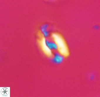 Helicosphaera gartneri VR 33090