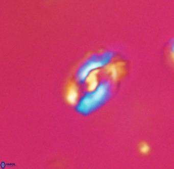 Helicosphaera gartneri VR 33091