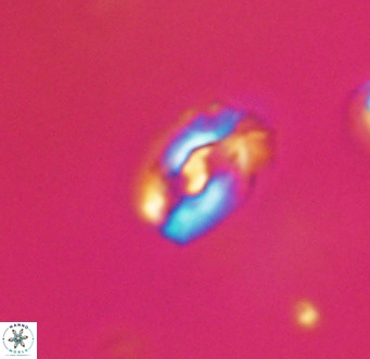 Helicosphaera gartneri VR 33091