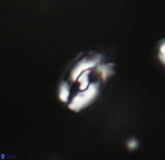 Helicosphaera gartneri VR 33092