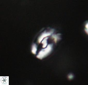 Helicosphaera gartneri VR 33092