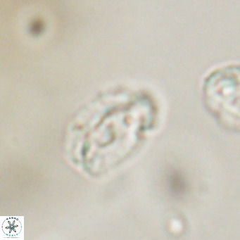 Helicosphaera gartneri VR 33093