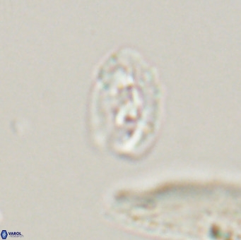 Helicosphaera gartneri VR 33104