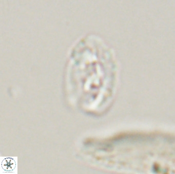 Helicosphaera gartneri VR 33104