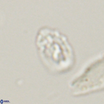 Helicosphaera gartneri VR 33105