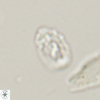 Helicosphaera gartneri VR 33105