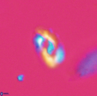 Helicosphaera gartneri VR 33107
