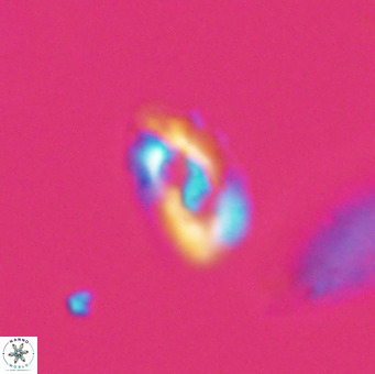 Helicosphaera gartneri VR 33107