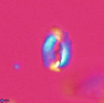 Helicosphaera gartneri VR 33108