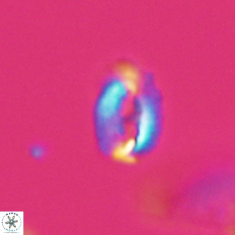 Helicosphaera gartneri VR 33108