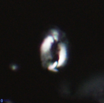 Helicosphaera gartneri VR 33109