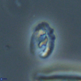 Helicosphaera gartneri VR 33100