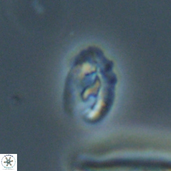 Helicosphaera gartneri VR 33100