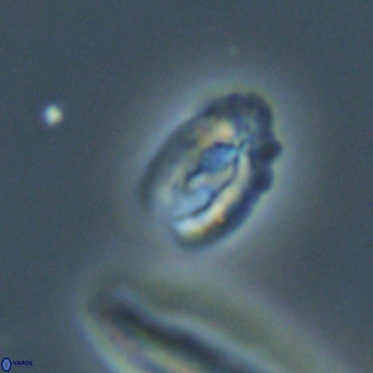 Helicosphaera gartneri VR 33101