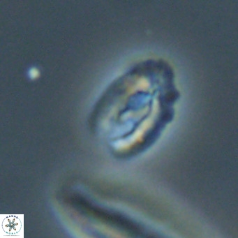 Helicosphaera gartneri VR 33101