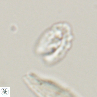 Helicosphaera gartneri VR 33102