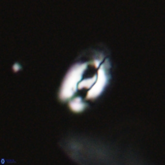 Helicosphaera gartneri VR 33110