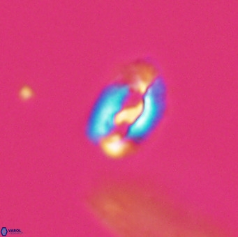 Helicosphaera gartneri VR 33111