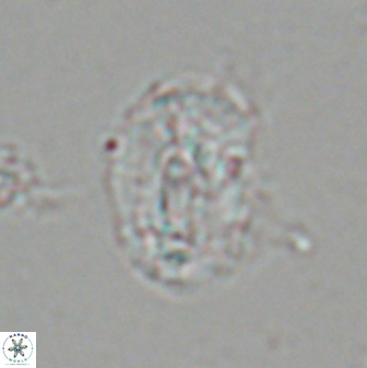 Helicosphaera granulata 22765