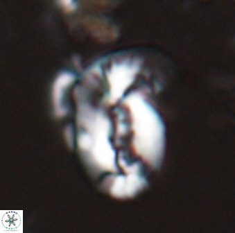 Helicosphaera granulata 26970