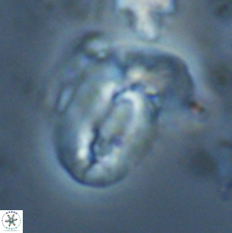 Helicosphaera granulata 26974