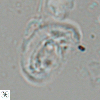 Helicosphaera granulata 26975