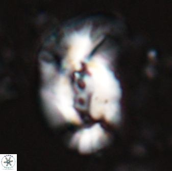 Helicosphaera granulata 27084