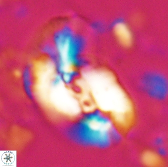 Helicosphaera granulata 27088
