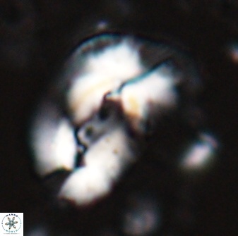 Helicosphaera granulata 27090