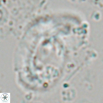 Helicosphaera granulata 27091