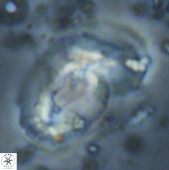 Helicosphaera granulata 27092
