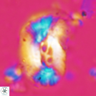 Helicosphaera granulatai 677