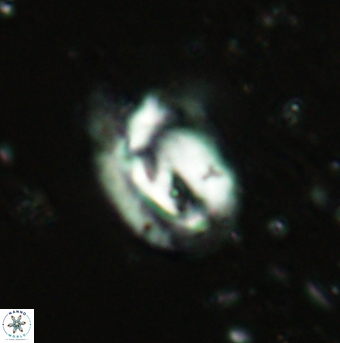 Helicosphaera grandeporis 2458